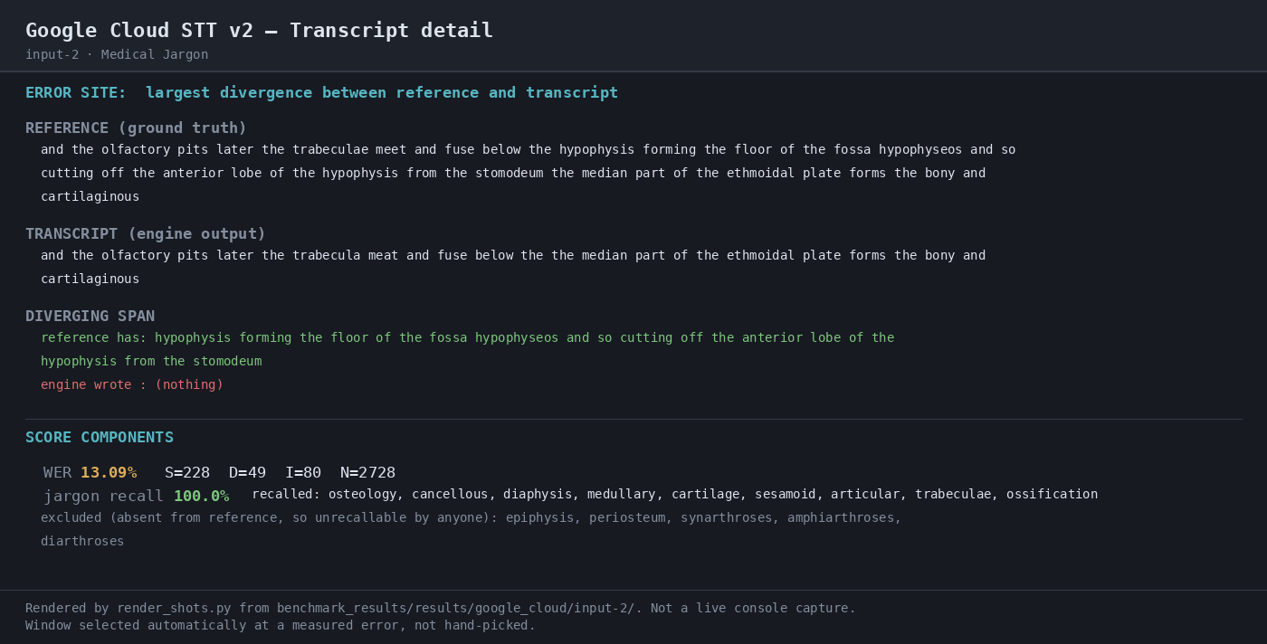 Output artifact for "Technical Terminology Transcription" test: Transcript detail for the medical sample; it shows 13.09% WER, 100.0% jargon recall, and a long omitted span in the middle of the transcript., 04-transcript-detail-input-2.png