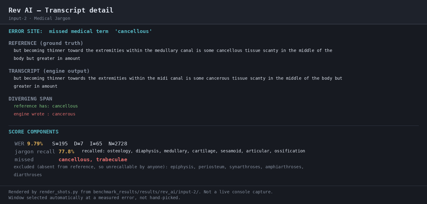 Output artifact for "Asynchronous Batch Transcription" test: WER 9.79% on the medical-jargon sample; the transcript missed 'cancellous' and 'trabeculae', but this was the strongest of the three inputs overall., 04-transcript-detail-2.png